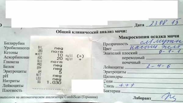 Что значит наличие уробилиногена в моче у ребенка: нормы и отклонения в показателях