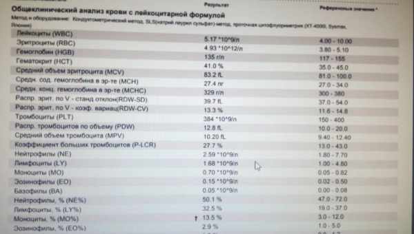 Содержание моноцитов в крови у ребенка: норма, повышенные и пониженные значения