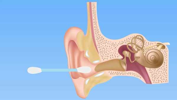 Как правильно чистить уши: советы врачей
