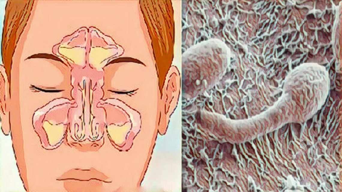В носу обнаружили полезные лактобациллы