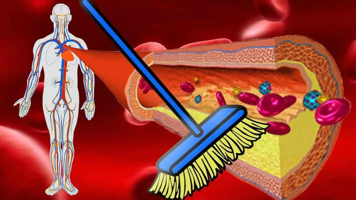 Клеточная чистка спасает от атеросклероза