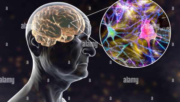 Мозг стареет из-за воспаления
